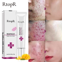 mango repair acne cream anti acne spots acne treatment scar blackhead cream shrink pores whitening moisturizing face skin care