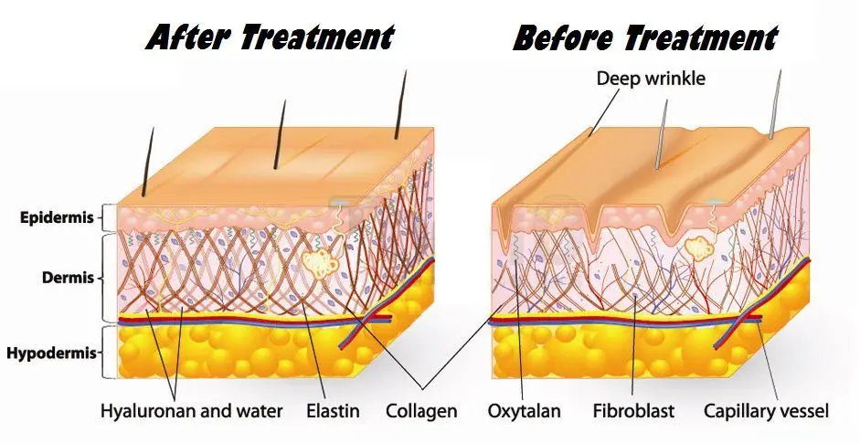 Гликолевая кислота 70% обновление пилинг Отшелушивающий чистый AHA Косметическая