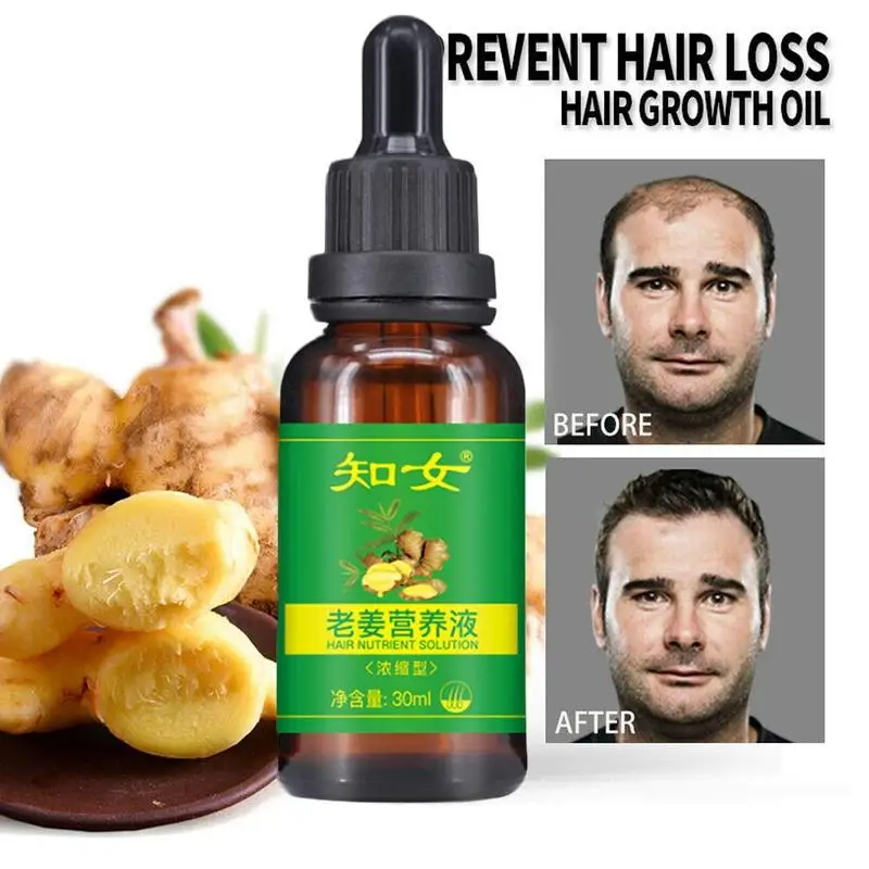 30ml Ginger Hairdressing Hairs Mask Hair Essential Oil Care Dry and Damaged Nutrition | Красота и здоровье