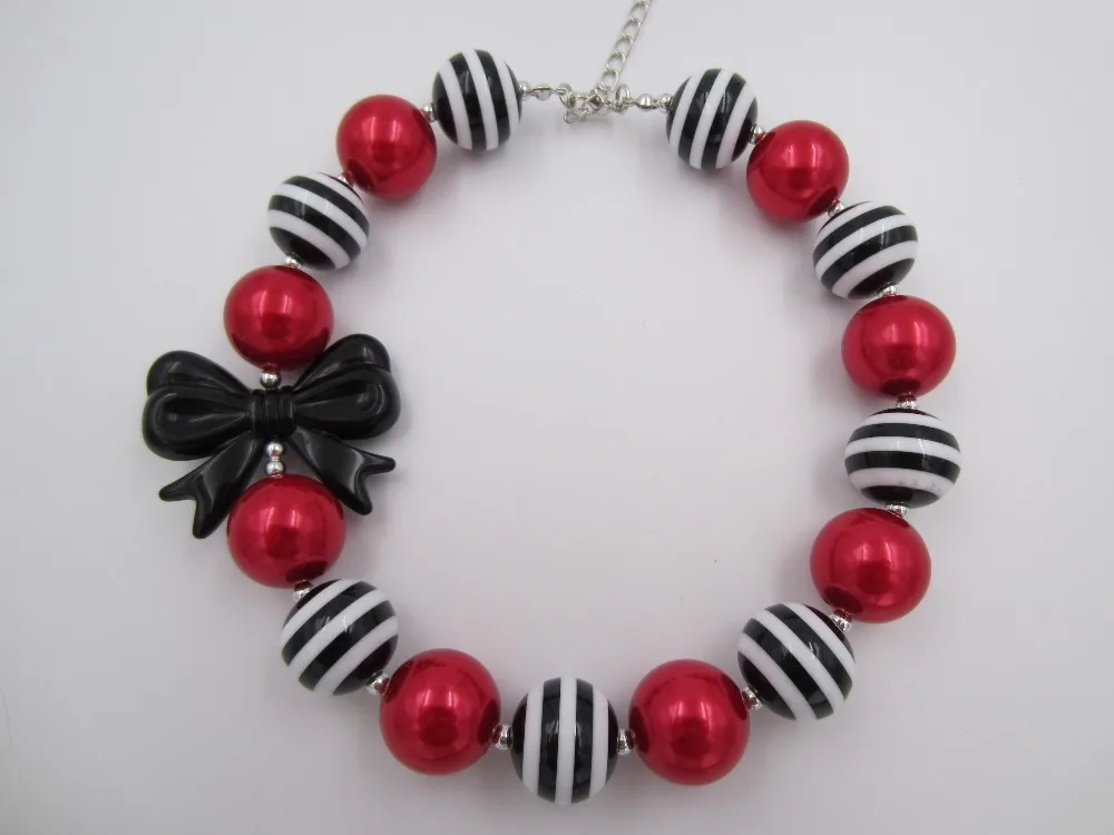 2 шт./компл. Детские милые подарки для девочек 20 мм в полоску массивные бусины