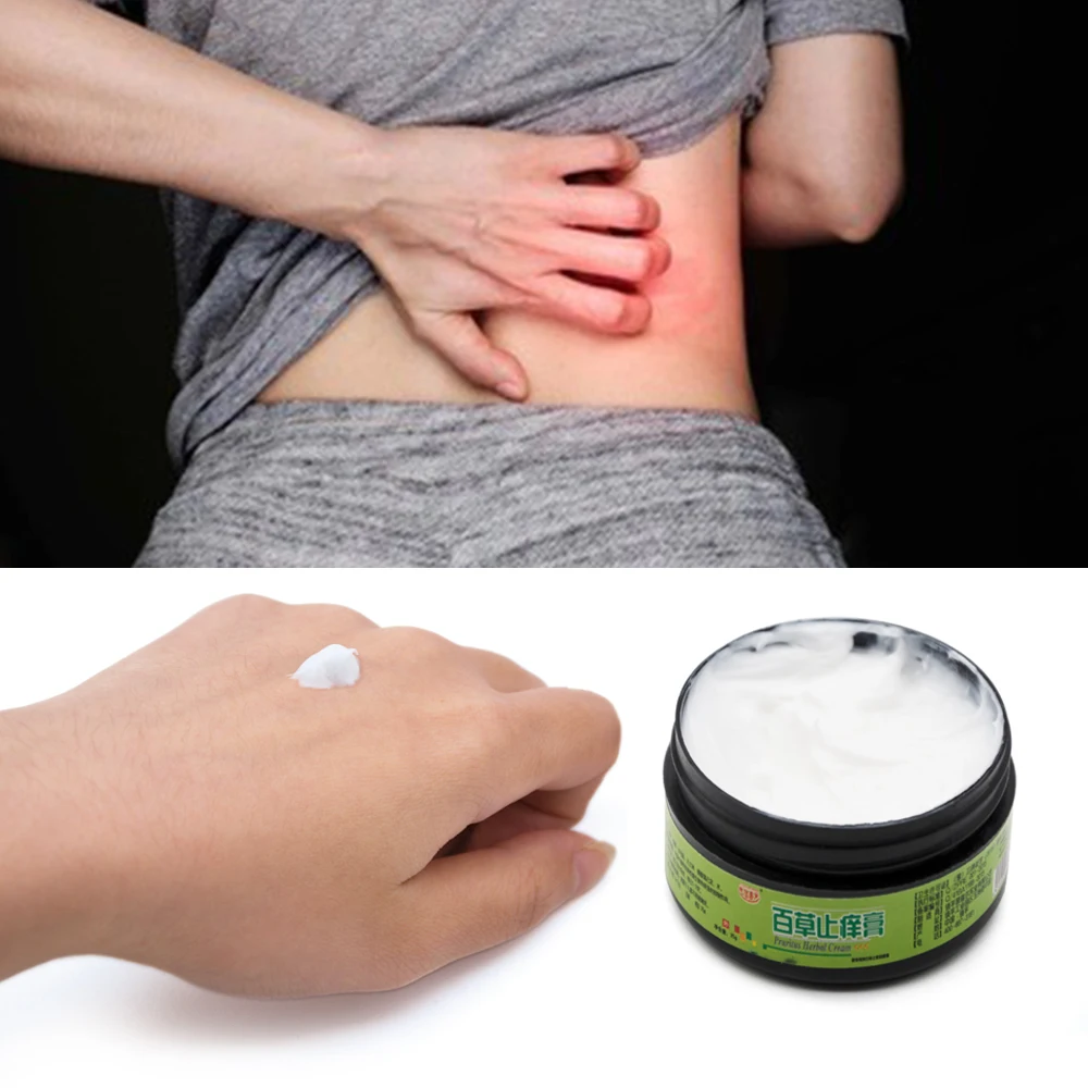 25 г болеутоляющая травяная медицинская штукатурка Eczema мазь псориаз кремы уход за