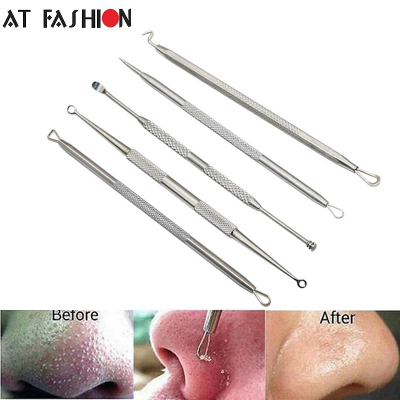  5 шт./набор для удаления черных точек моднок ювелирное изделие от прыщей пятна