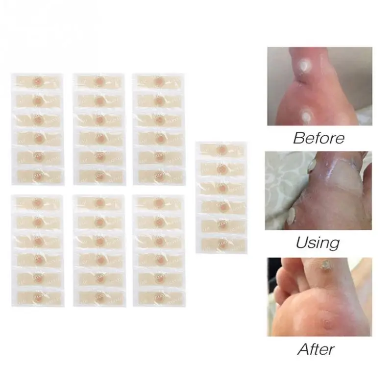 Пластырь для удаления мозолей 7 шт.|Инструмент ухода за ступнями| |
