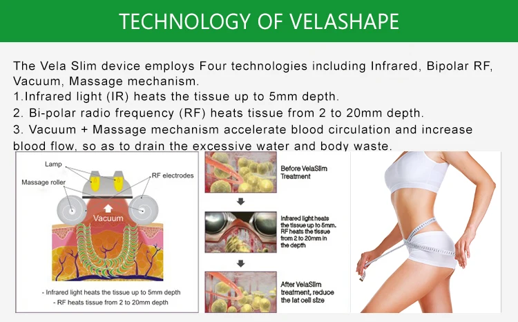 Высокое качество velashape машина для удаления целлюлита/velashape многофункциональное физиотерапевтическое оборудование