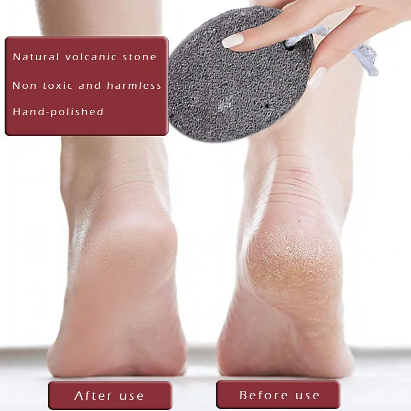 6 шт. камень для ног|hard skin|pumice stonenatural pumice |