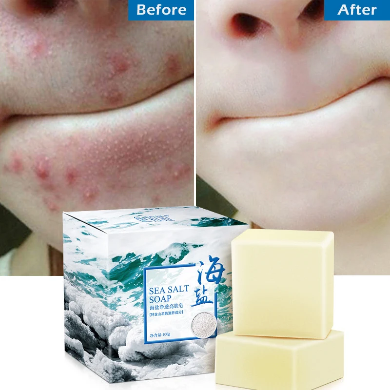 

60g Removal Pimple Pore Acne Treatment Sea Salt Soap Cleaner Moisturizing Goat Milk Soap Face Care Wash Basis Soap