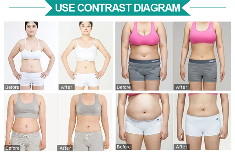 

2019 Portable double handles ultrasound RF weight loss machine for sale use for clinic CE