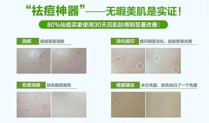 10 шт. Увлажняющие гелевые маски для лица с экстрактом алоэ вера|mask face care|face carefacial