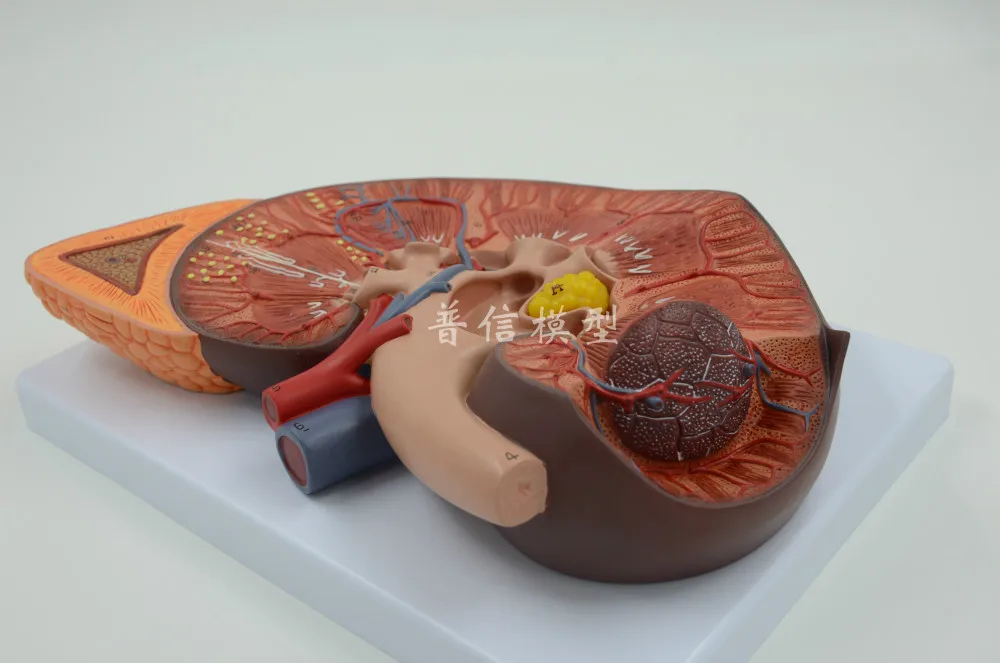Бесплатная доставка и надпочечник модель почечной анатомии для урологического