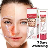 25g dark spot removal fade blemish melasma treatment whitening cream reduce freckle facial care