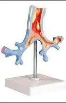 Медицинская дыхательная система патологическая модель бронхов бесплатная