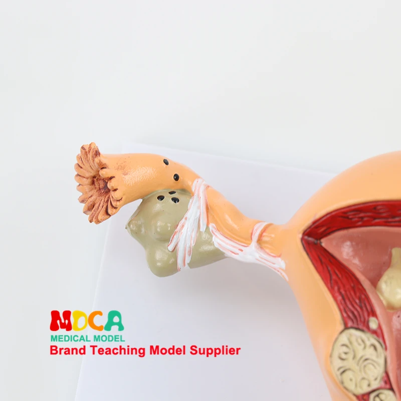 

Medical Teaching of Pathological Uterine Reproductive Model for Family Planning Uterine Reproductive Anatomy Model MSZXT001