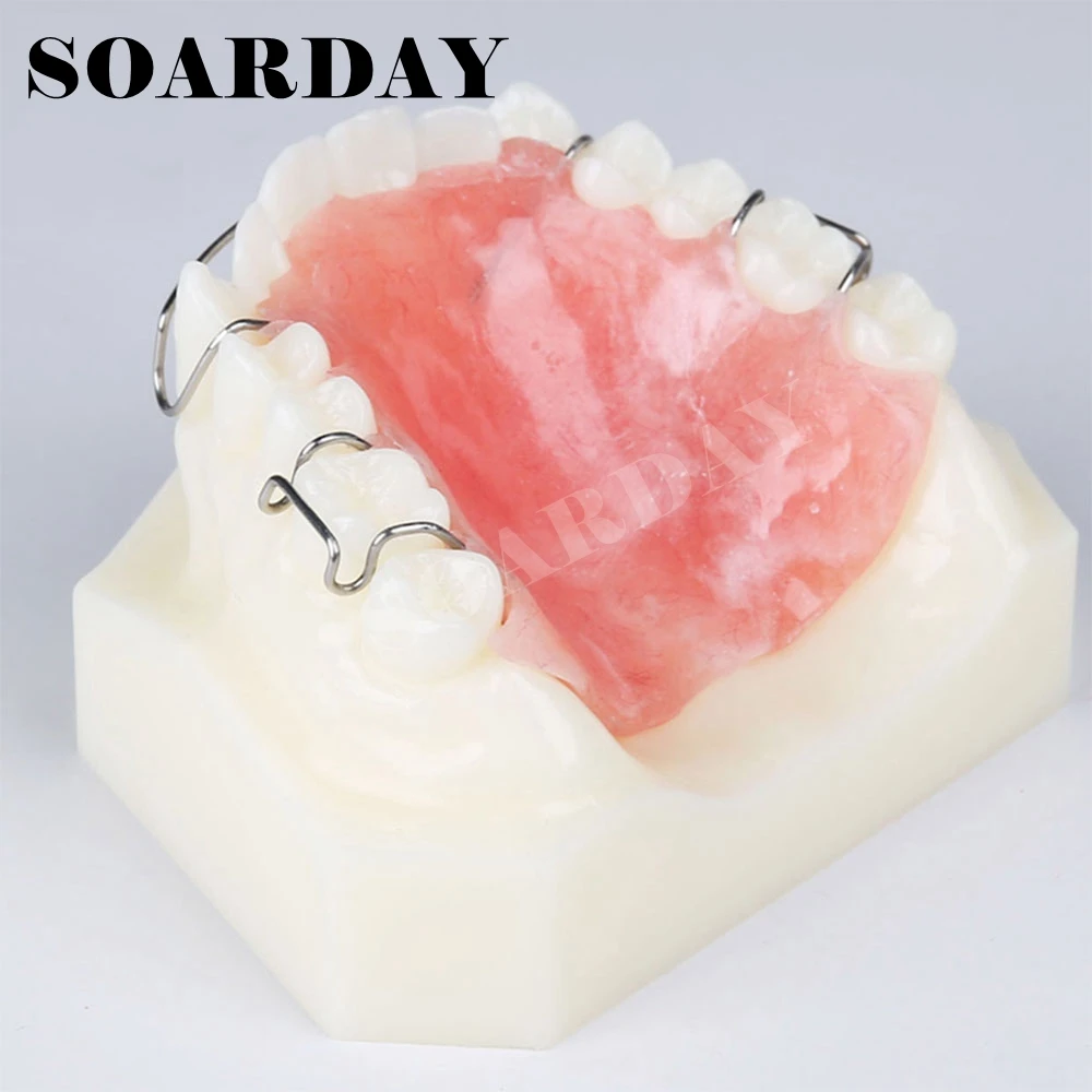 Зубной фиксатор демонстрационная модель ортодонтической терапии|orthodontic model|dental