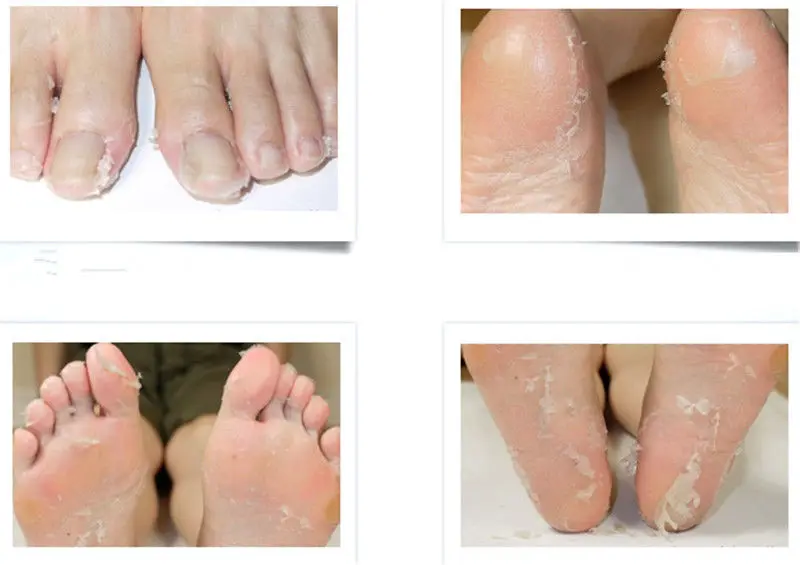 YANQINA 1Pcs Baby Foot Peeling Renewal Exfoliate Mask Remove Dead Skin Cuticles |