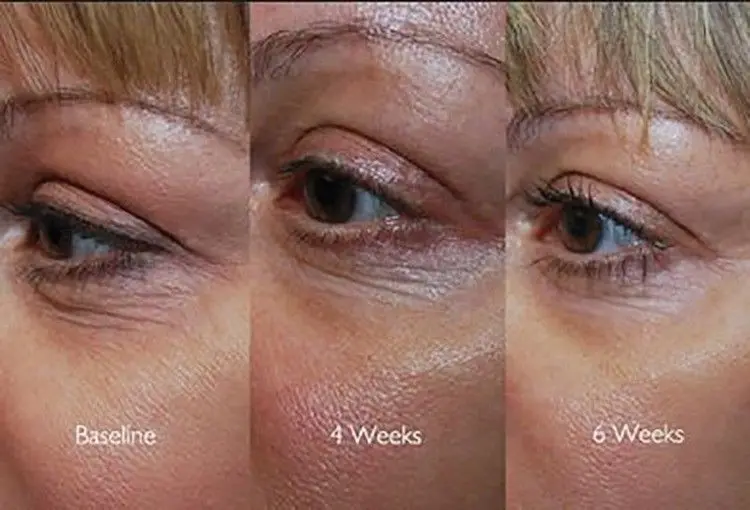 

Collagen Serum Facial Firming Peptide CoEnzyme (CoQ10) Matrixyl Hyaluronic Acid