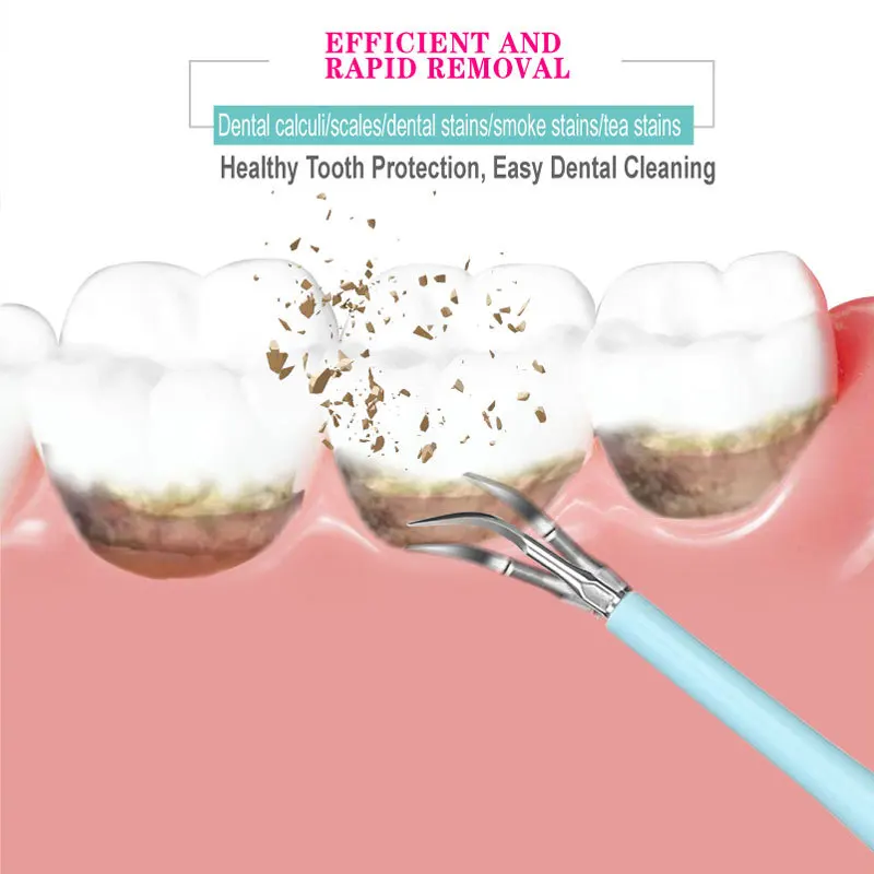 

New upgrade of dental cleaner, replaceable multi-functional remover for cleaning calculus, scales and stains of teeth