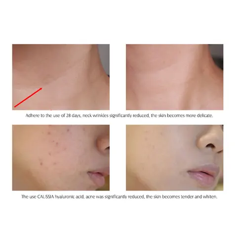 ARTISCARE Сыворотка для лица с гиалуроновой кислотой 3 шт.