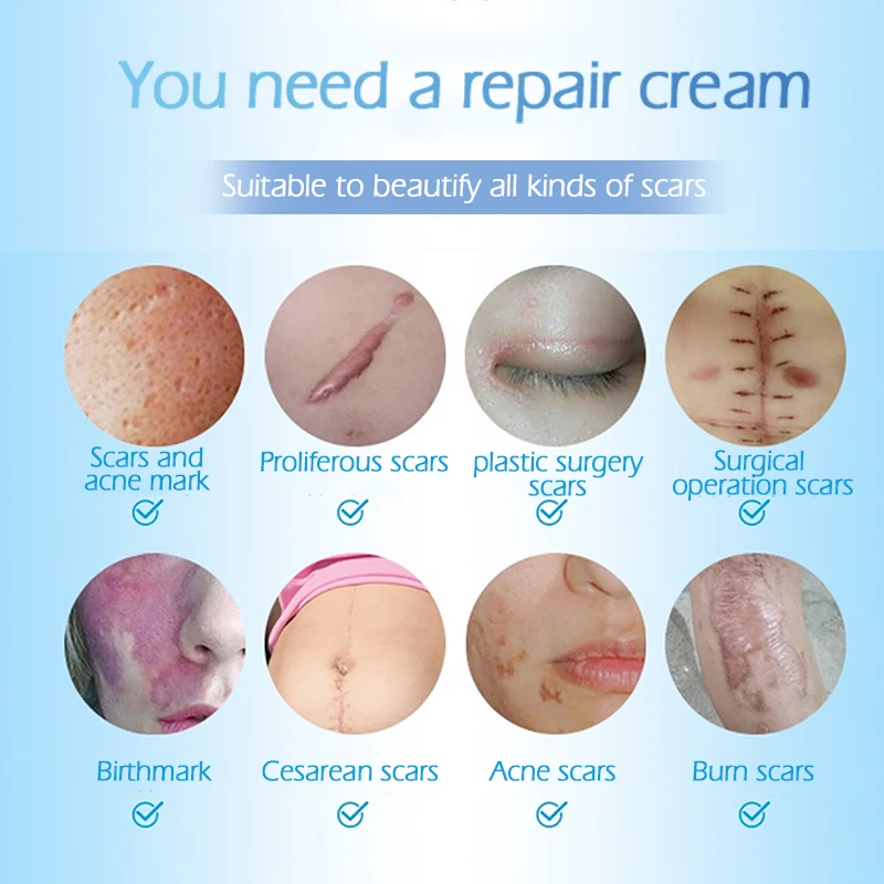 Одежда для кожи травяная эссенция Восстанавливающий шрам крем удаление шрамов