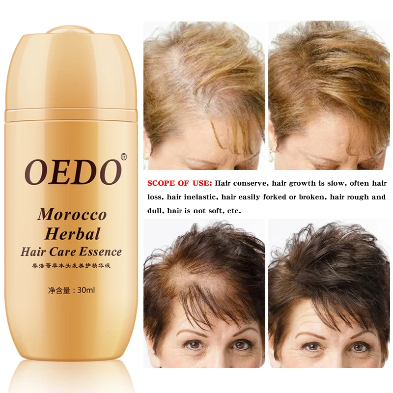 Густая длинная фотоэссенция против выпадения волос средство для ухода за
