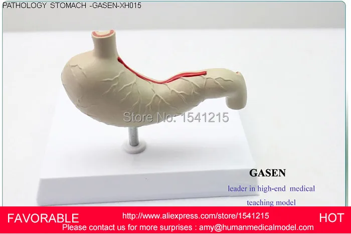 Анатомическая модель желудка анатомия анатомии человека желудочно кишечного