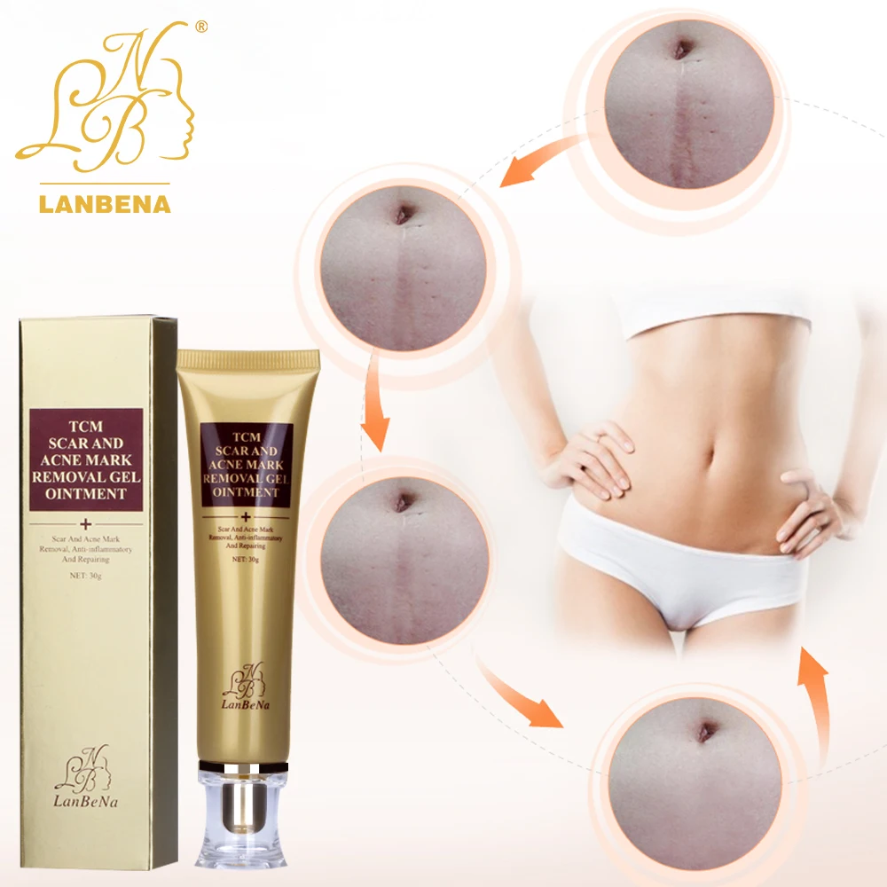 Акне шрам крем женьшень эссенция против акне для удаления угрей уход за лицом