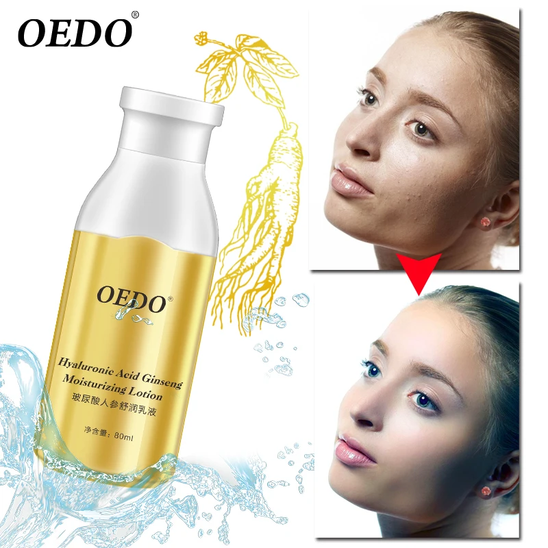 Гиалуроновая кислота экстракт женьшеня увлажняющий лосьон для ухода за кожей