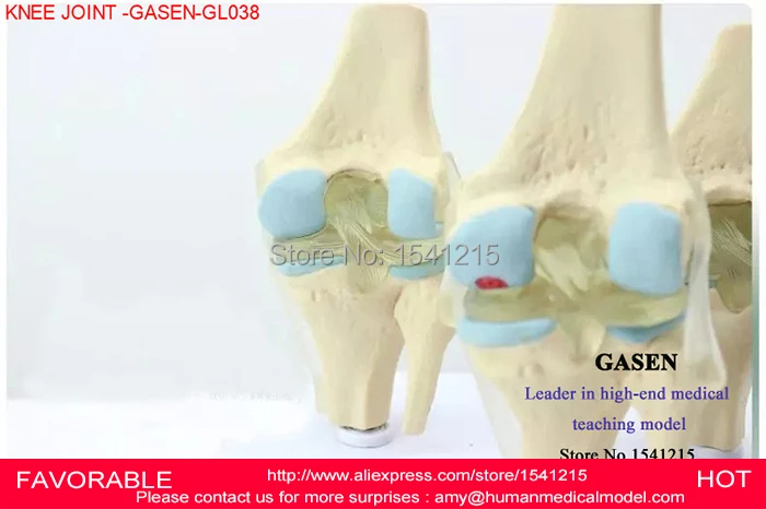Модель коленного сустава модель человеческого скелета артропатия патология