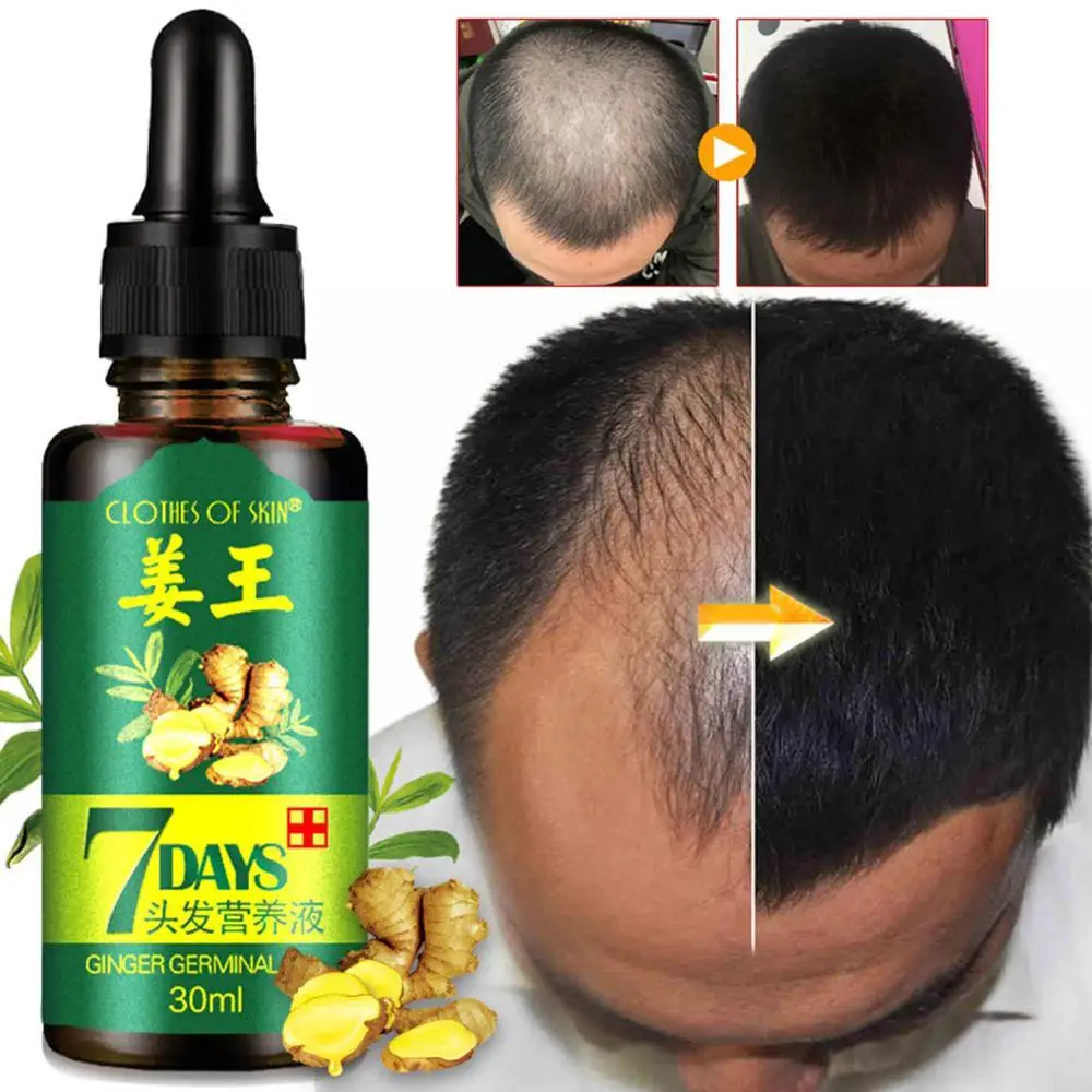 

30ml Hair Growth Essence Serum Fast Powerful Hair Essential Oil Liquid Treatment Preventing Hair Loss Products Health Hair Care