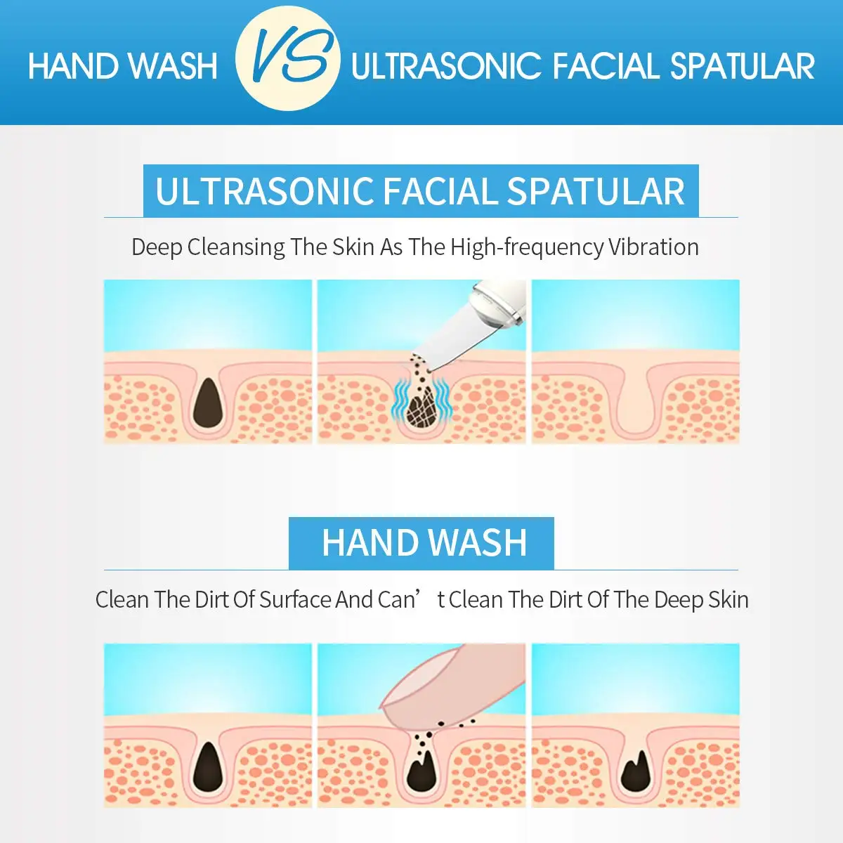 Скребок для кожи лица устройство удаления черных точек очищающее средство