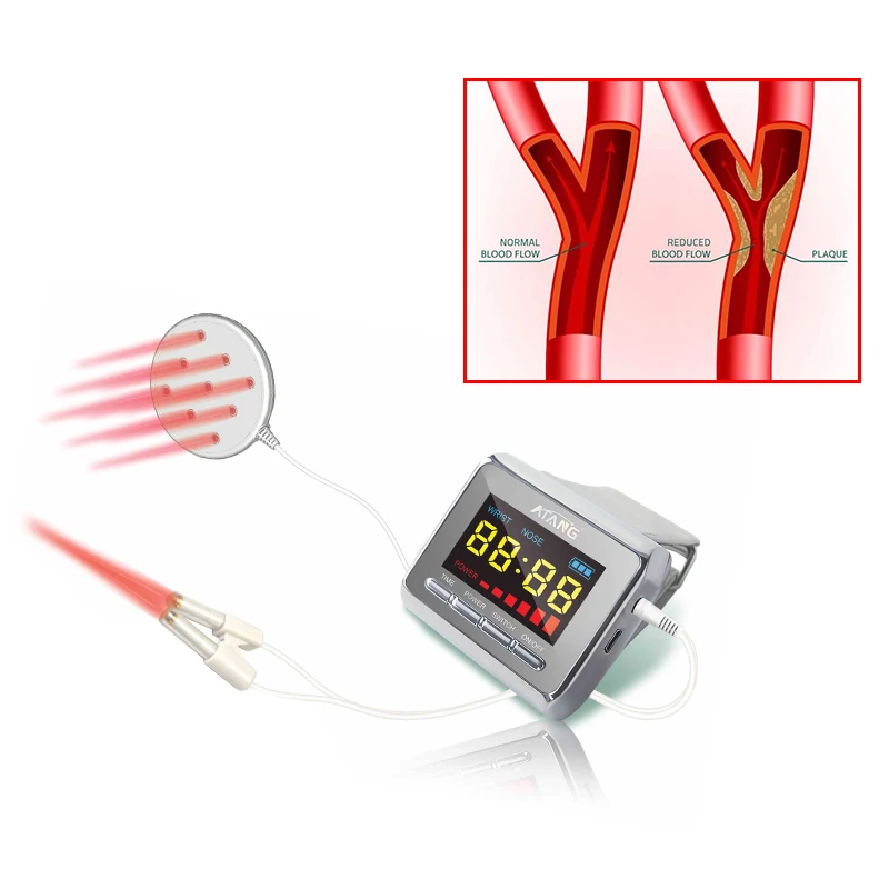 Лазер 650 нм для диабетиков уровень холестерина сахара в крови Новое поступление