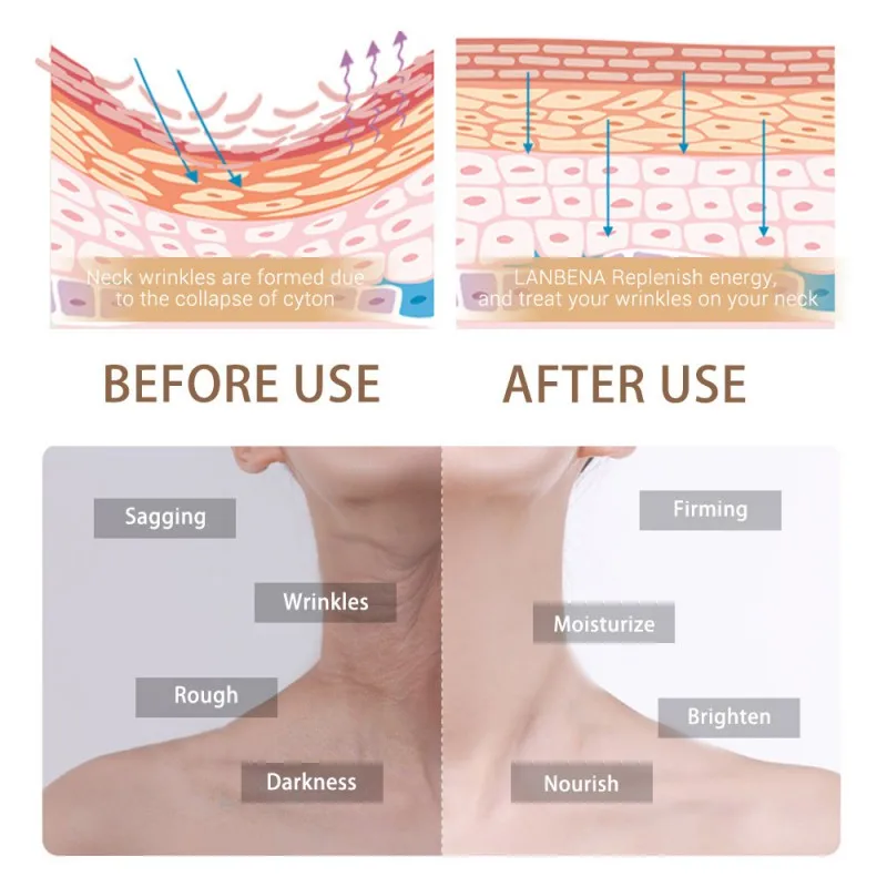 Hydrating Neck Care Cream Mask Anti Wrinkle Firming Moisturizing Reduce Fine Lines Relieving Beauty Skin | Красота и здоровье