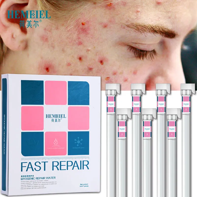 3ml x 7pcs Hemeiel быстрого ремонта уход за кожей лица Сыворотки растений эссенция лечение шрамов, от угрей удаления увлажняющий отбеливающий крем для лица Уход за лицом уход за кожей с сывороткой в Корейском стиле - Вес нетто: 3ml x 7pcs
