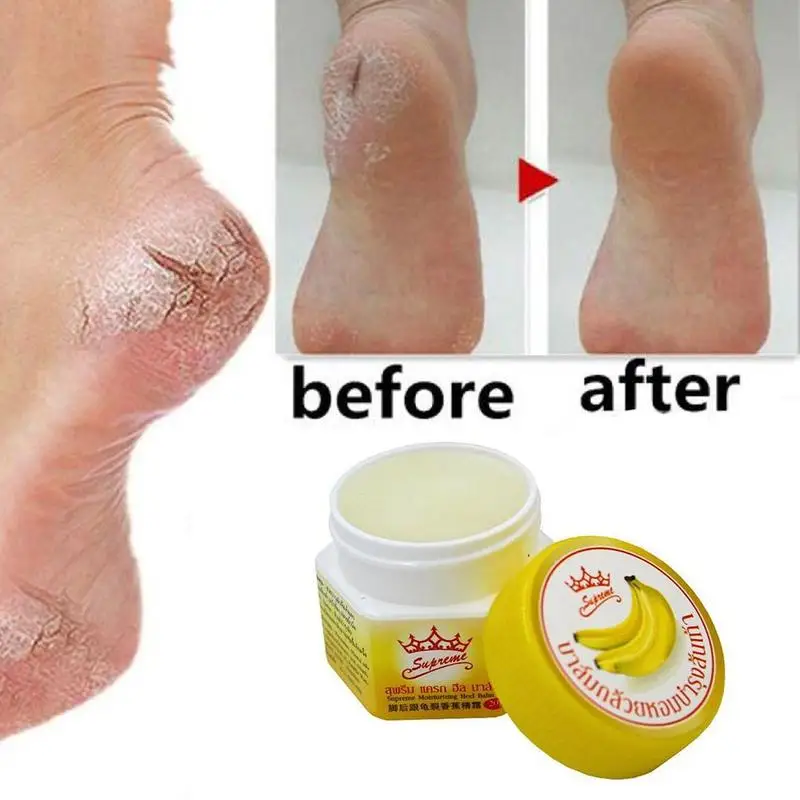 Крем для кожи в виде банана увлажнение предотвращение сухости и трещин|Пластыри