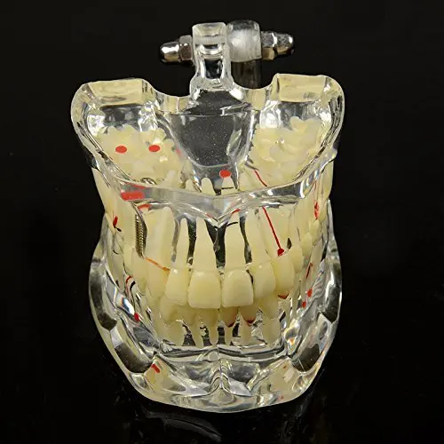 1 PC Adult Pathologies Demonstration Model Dental Study Model