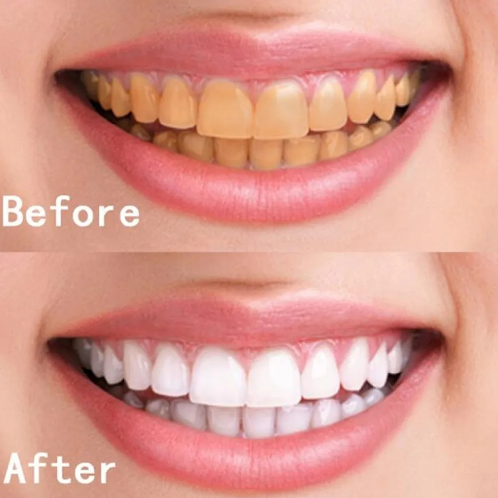 10 мл отбеливающая вода для гигиены полости рта уход за зубами T ooth Чистка