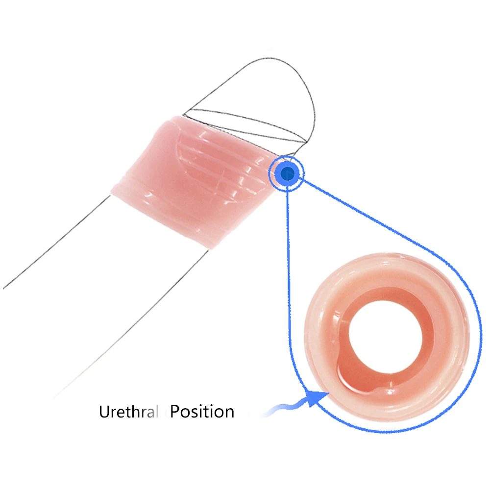 2 шт./компл. кольцо на пенис коррекция Foreskin мужское устройство верности Задержка