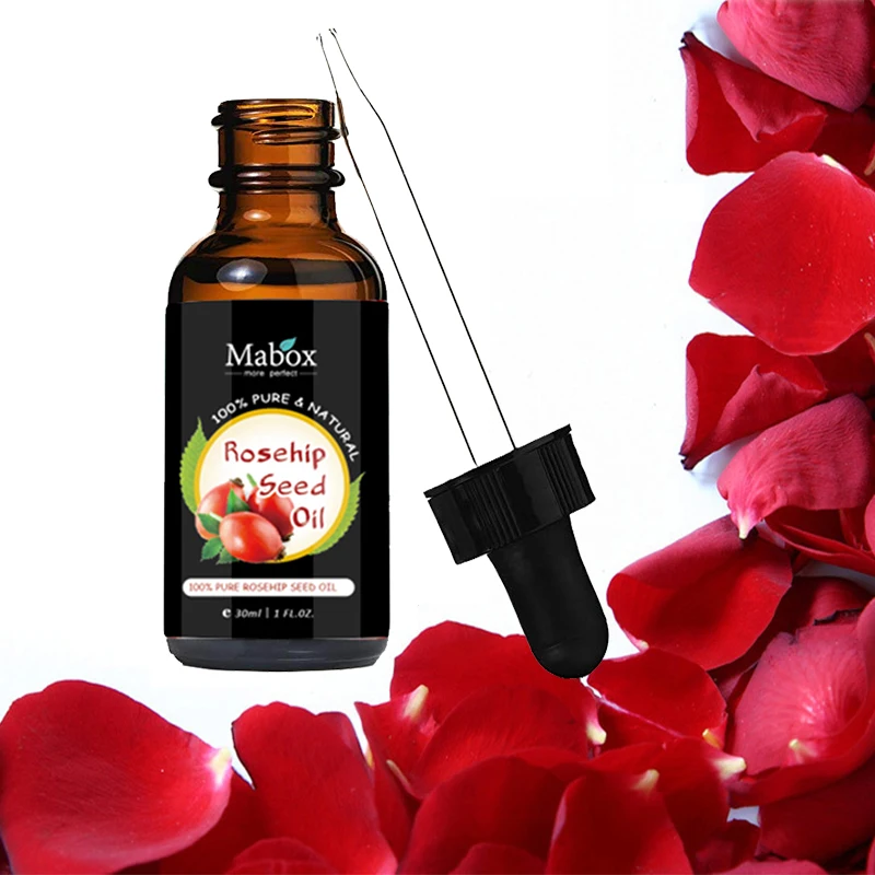 

Rose Essential Oil (PURE & NATURAL - UNDILUTED) Therapeutic Grade - Perfect for Aromatherapy, Relaxation, Skin Therapy & More!