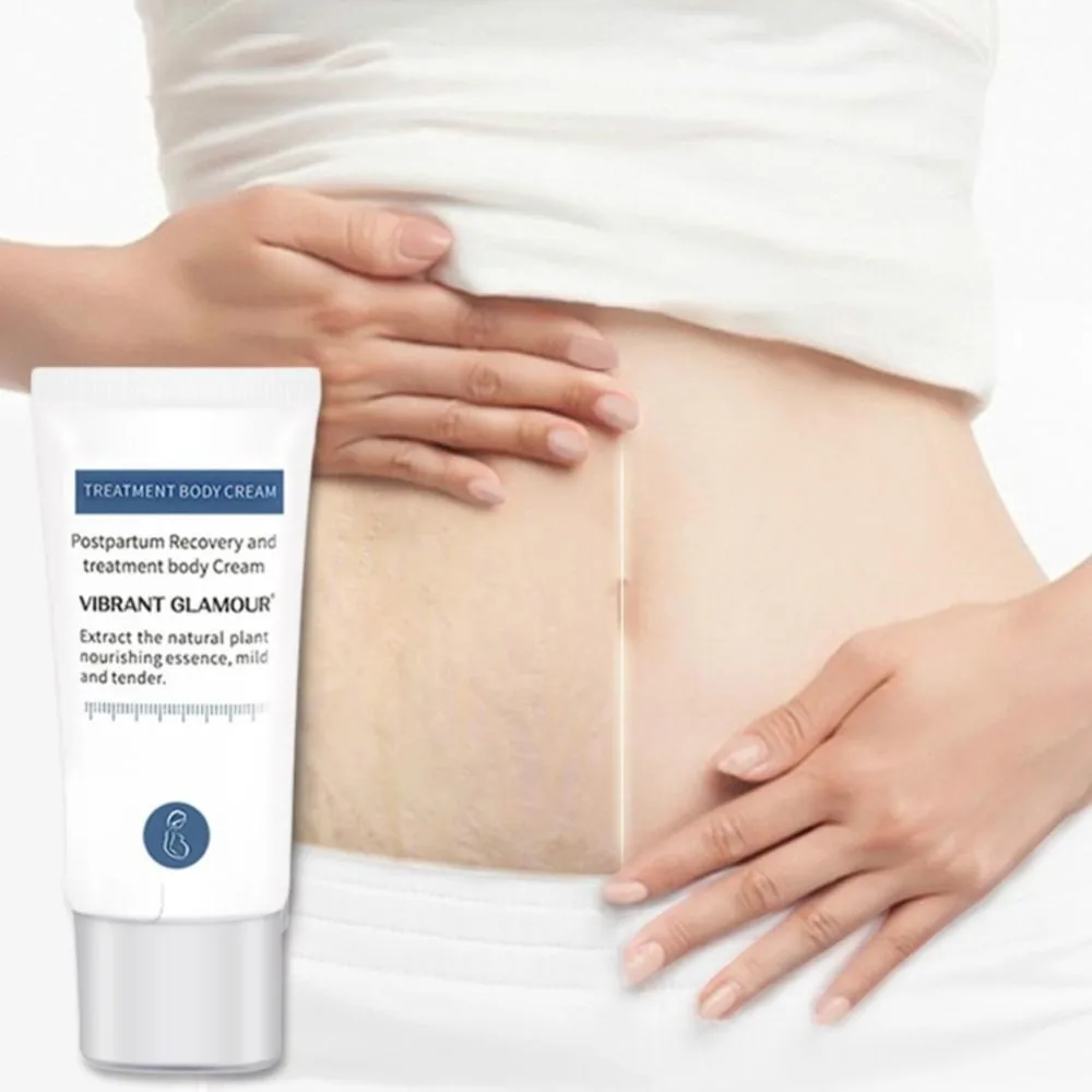 

VIBRANT GLAMOUR Stretch Mark Cream for Pregnant Women Postpartum Repair Cream Obesity Growth Pattern Free Shiping
