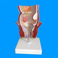 anorectal pathological model anorectal hemorrhoids anal fistula crack disease model anorectal medical teaching supplies