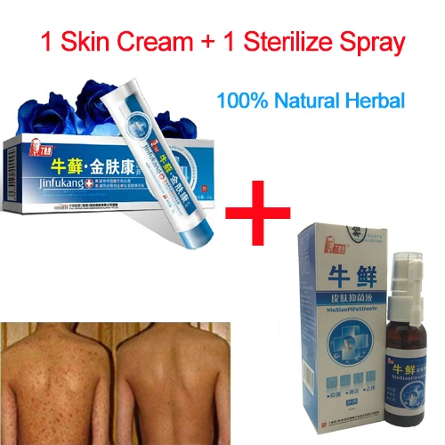 Крем псориаз + комбинация псориаза 100% оригинальное мощное профессиональное