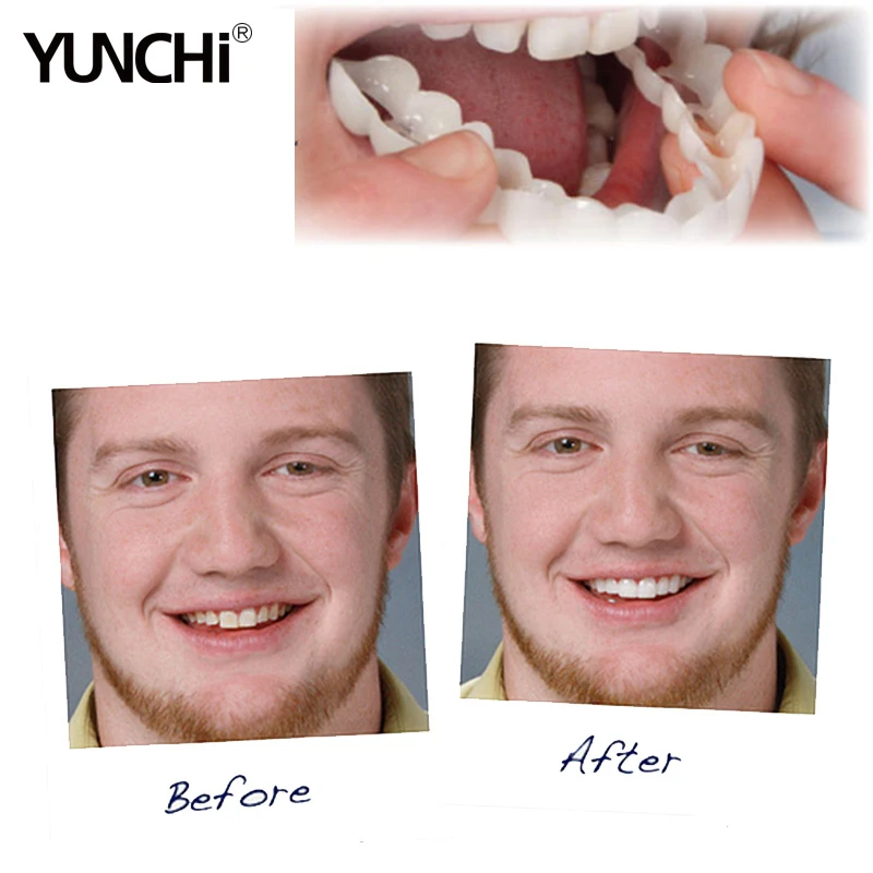 Силиконовая крышка для зубов YunChi Snap на улыбке Мгновенное Отбеливание