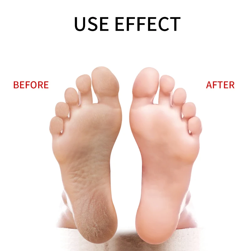 

Professional Pedicure Foot File Heel Grater For The Feet Pedicure Remover Luxury Stainless Steel Manicure Nail Tools JB13