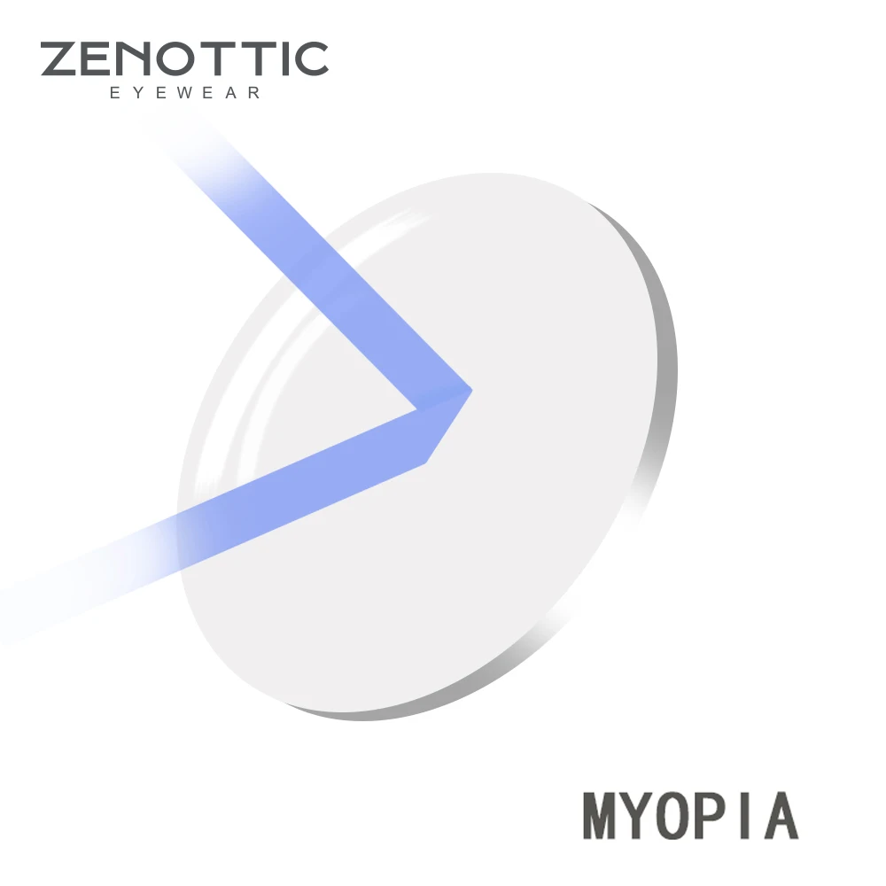 ZENOTTIC по рецепту, прогрессивный стандарт Blu-Ray объектив 1,56 1,61 1,67(+ 12,00~-12,00) при дальнозоркости, близорукость дальнозоркость, оптические линзы - Цвет линз: Myopia
