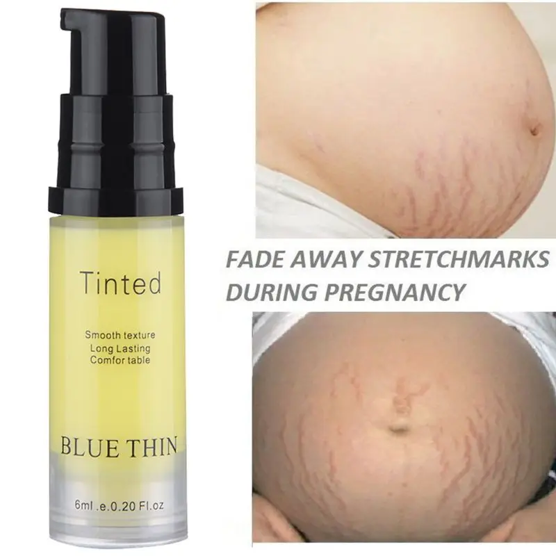 6 мл растяжек восстанавливающий крем для удаления шрамов прыщей подтягивает