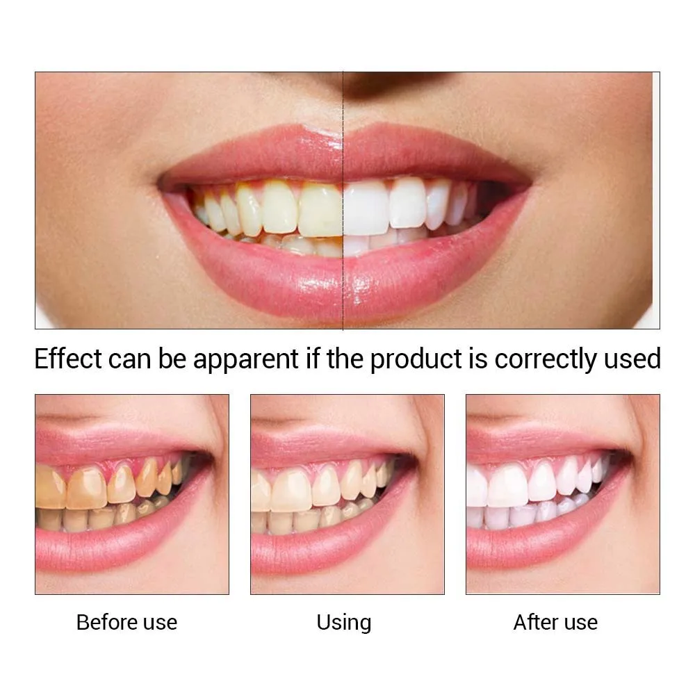 LANBENA Teeth Whitening Petrol Powder Cleaning Serum Removes Plaque Blemishes Dental Tools Face Care | Красота и здоровье