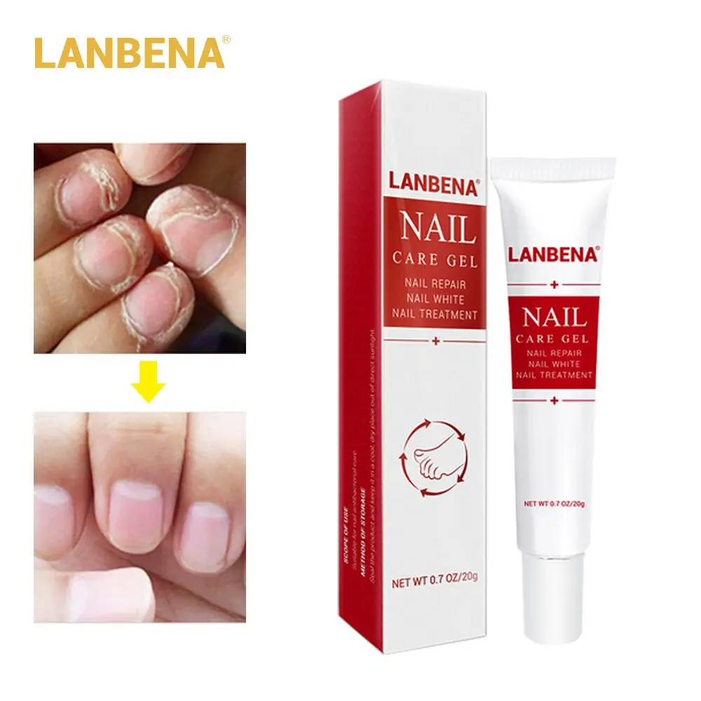 LANBENA травяной крем для ремонта ногтей грибковое Лечение Удаление онихомикоза