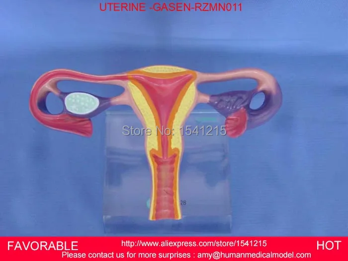 UTERUS &ampOVARY COMMON PATHOLOGIES UTERINE DISEASE OVARIAN ANATOMICAL MODEL OBSTETRICS GYNECOLOGY -GASEN-RZMN011 | Канцтовары для