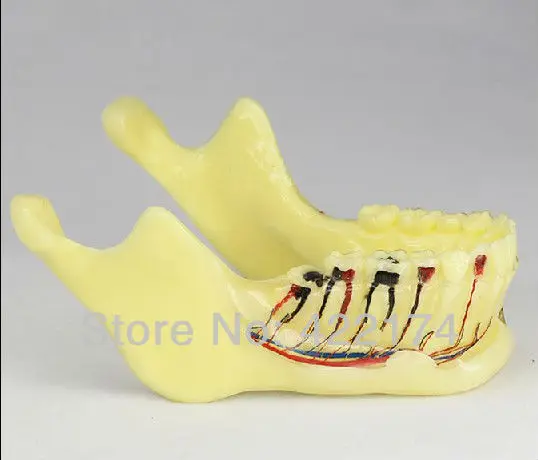 

Free Shipping Pathologies of the lower jaw model dental tooth teeth dentist anatomical anatomy model odontologia