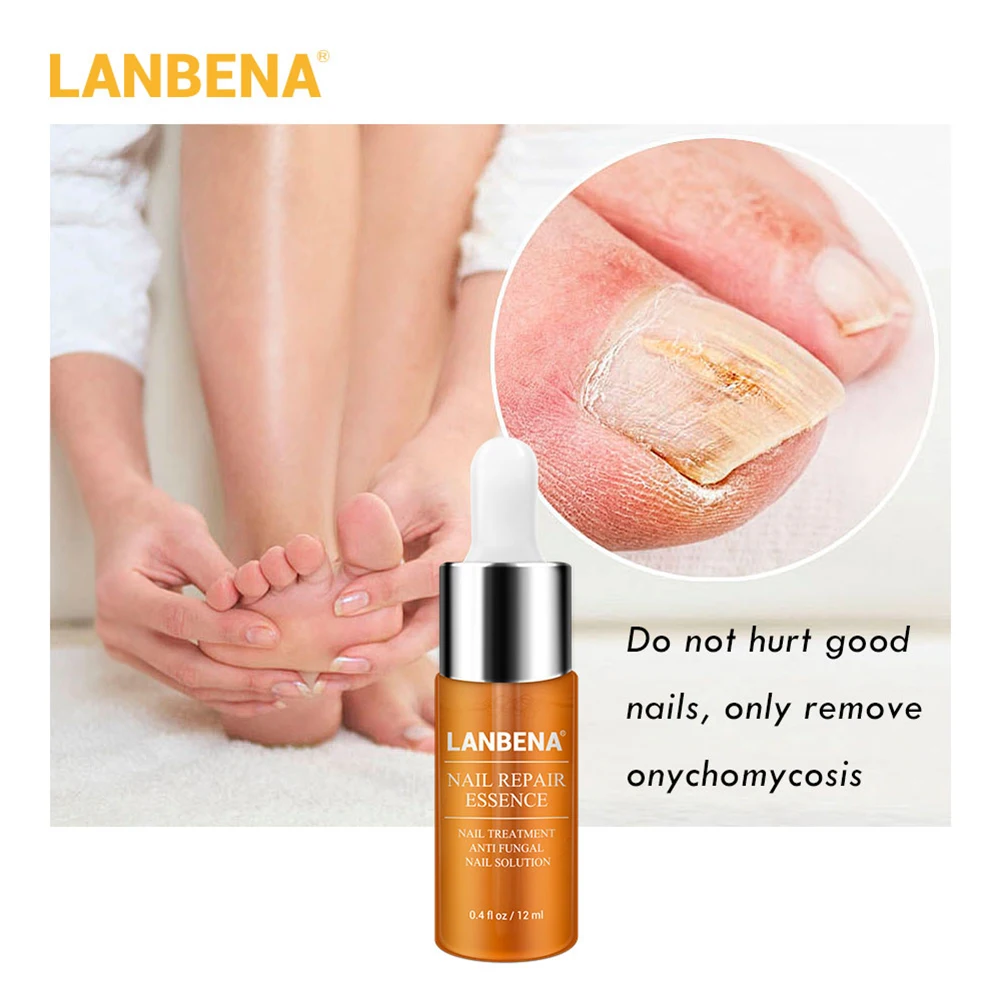 Жидкость для ремонта ногтей 12 мл лечебное масло удаления грибка на носках