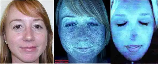 Портативный прибор для анализа проблем кожи лица|machine machine|machine skinmachine beauty |